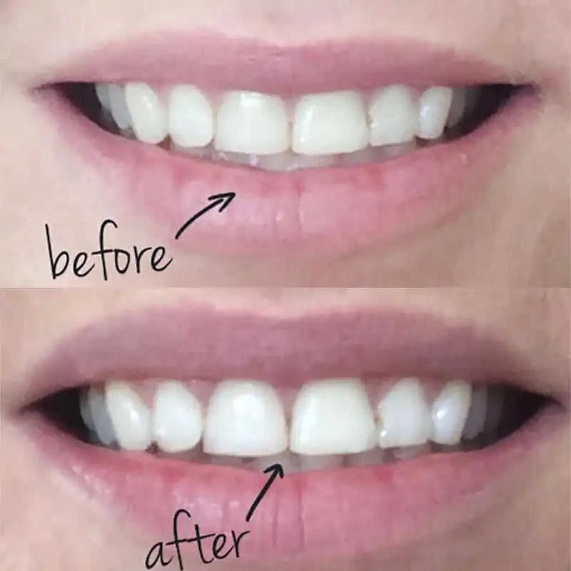 30g Premium Activated Bamboo Charcoal Teeth Whitening Powder Eco My Home  Natural Toothbrush ecomyhome.store United States