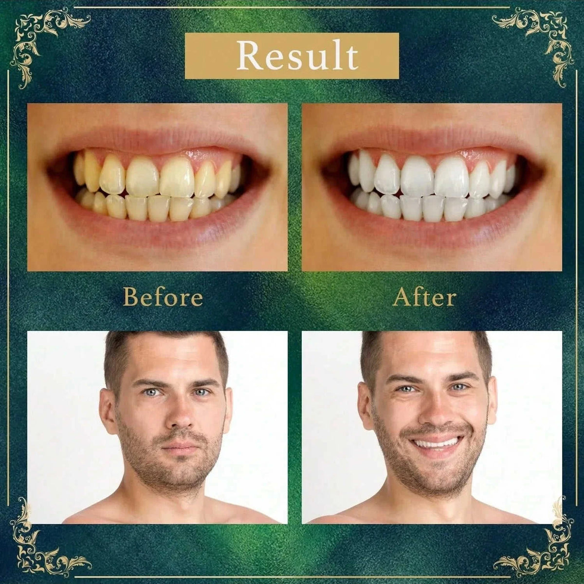 Natural Branch Miswak Toothbrush Stick Eco My Home  Natural Toothbrush ecomyhome.store United States